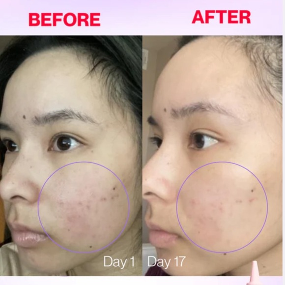 Kiramoon silkie rinse - Picture 2 of 6